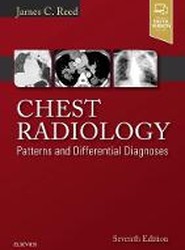 Chest Radiology