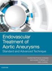 Endovascular Treatment of Aortic Aneurysms