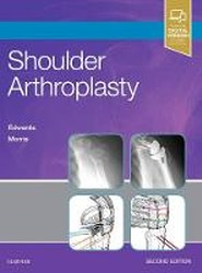 Shoulder Arthroplasty