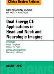 Dual Energy CT: Applications in Head and Neck and Neurologic Imaging, An Issue of Neuroimaging Clinics of North America: Volume 27-3