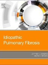 Idiopathic Pulmonary Fibrosis