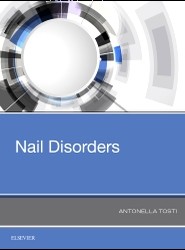 Nail Disorders
