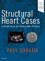 Structural Heart Cases