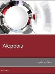 Alopecia
