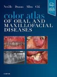 Color Atlas of Oral and Maxillofacial Diseases