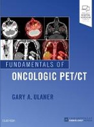 Fundamentals of Oncologic PET/CT