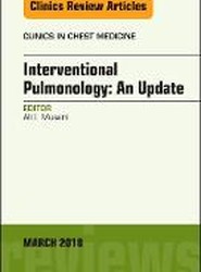 Interventional Pulmonology, An Issue of Clinics in Chest Medicine: Volume 39-1