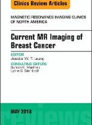 Current MR Imaging of Breast Cancer, An Issue of Magnetic Resonance Imaging Clinics of North America: Volume 26-2
