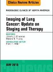 Lung Cancer, An Issue of Radiologic Clinics of North America: Volume 56-3