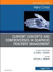 Current Concepts and Controversies in Scaphoid Fracture Management, An Issue of Hand Clinics: Volume 35-3