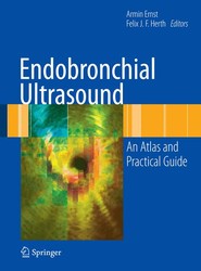 Endobronchial Ultrasound