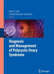 Diagnosis and Management of Polycystic Ovary Syndrome