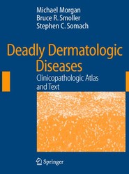 Deadly Dermatologic Diseases