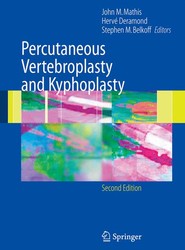 Percutaneous Vertebroplasty and Kyphoplasty