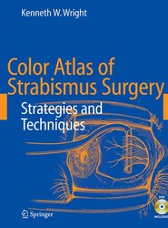 Color Atlas of Strabismus Surgery