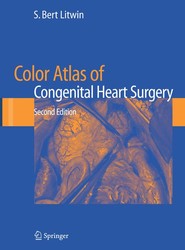 Color Atlas of Congenital Heart Surgery