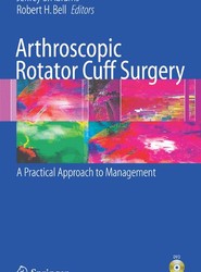 Arthroscopic Rotator Cuff Surgery