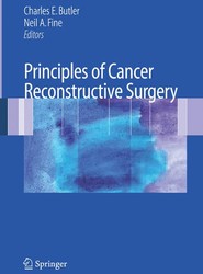 Principles of Cancer Reconstructive Surgery