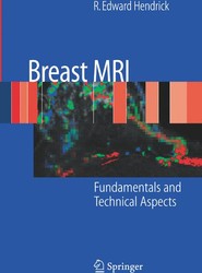 Breast MRI