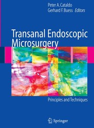 Transanal Endoscopic Microsurgery