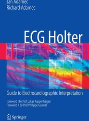 ECG Holter