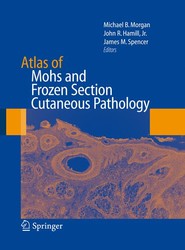 Atlas of Mohs and Frozen Section Cutaneous Pathology