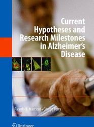 Current Hypotheses and Research Milestones in Alzheimer's Disease