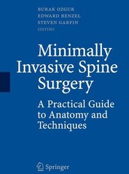 Minimally Invasive Spine Surgery