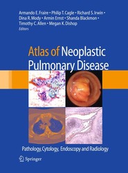 Atlas of Neoplastic Pulmonary Disease