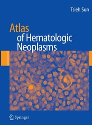Atlas of Hematologic Neoplasms