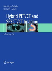 Hybrid PET/CT and SPECT/CT Imaging