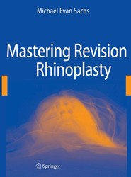 Mastering Revision Rhinoplasty