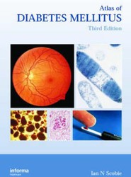 Atlas of Diabetes Mellitus, Third Edition