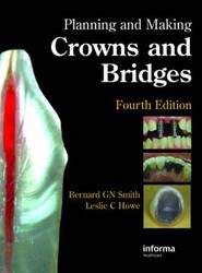 Planning and Making Crowns and Bridges