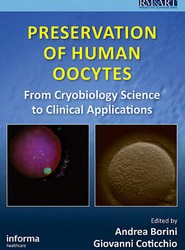 Preservation of Human Oocytes