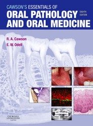 Cawson's Essentials of Oral Pathology and Oral Medicine