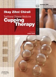 Traditional Chinese Medicine Cupping Therapy