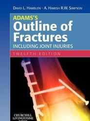 Adams's Outline of Fractures
