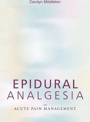 Epidural Analgesia in Acute Pain Management