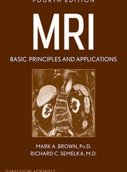 MRI