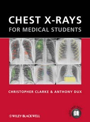 Chest X-rays for Medical Students