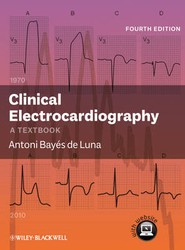 Clinical Electrocardiography