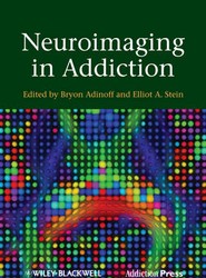 Neuroimaging in Addiction