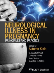 Neurological Illness in Pregnancy - Principles and Practice