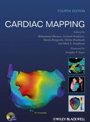 Cardiac Mapping