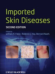 Imported Skin Diseases 2e