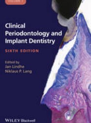 Clinical Periodontology and Implant Dentistry, 2 Volume Set