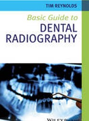 Basic Guide to Dental Radiography
