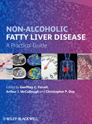 Non-Alcoholic Fatty Liver Disease - A Practical Guide