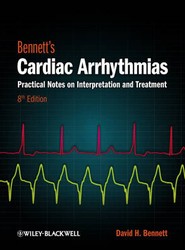Bennett's Cardiac Arrhythmias - Practical Notes on Interpretation and Treatment 8e